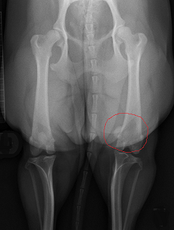 X-ray of cavalier's displaced right patella