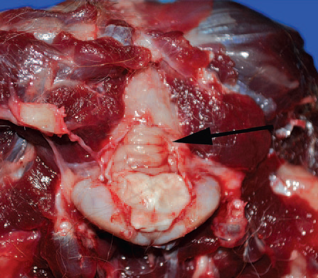 Clarke: Malformation of the caudal fossa of the occipital bone with visualization of the vermis