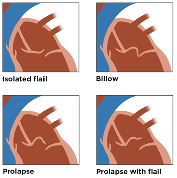 Leaflet Morphology